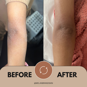 MelanMoisture Extreme Cream