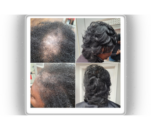 D’Serv Chebe Food Treatment